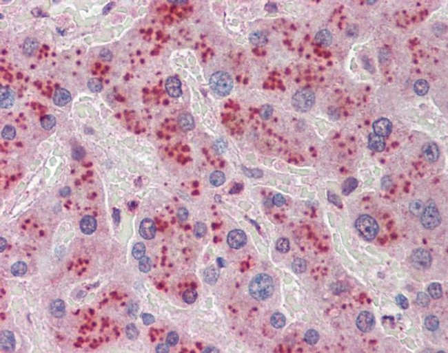 NDRG2 Antibody in Immunohistochemistry (IHC)
