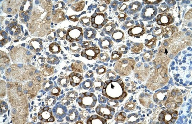 ST14 Antibody in Immunohistochemistry (IHC)