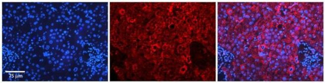 APEH Antibody in Immunohistochemistry (Paraffin) (IHC (P))