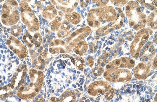 ENO3 Antibody in Immunohistochemistry (IHC)