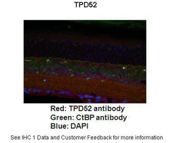 TPD52 Antibody in Immunohistochemistry (IHC)