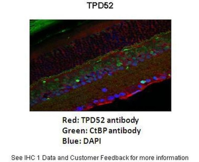 TPD52 Antibody in Immunohistochemistry (IHC)
