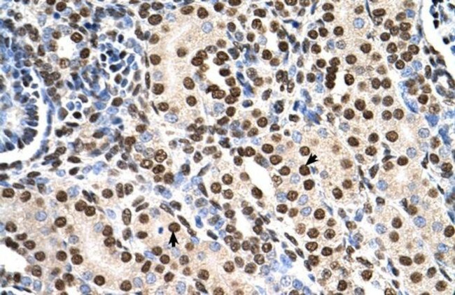 RSU1 Antibody in Immunohistochemistry (IHC)