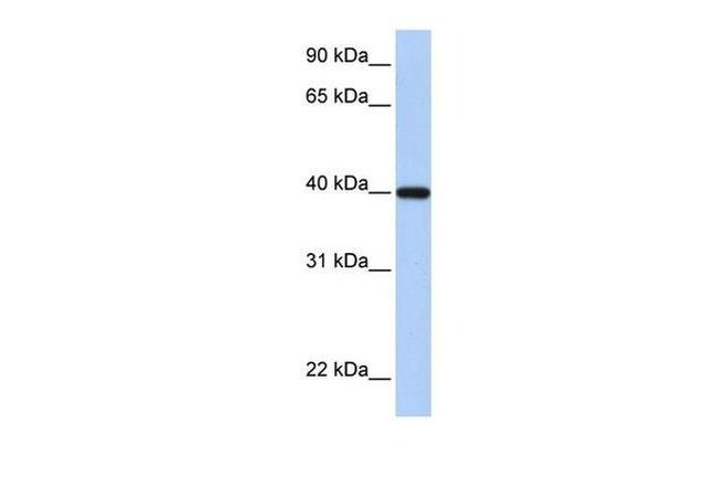 RDH11 Antibody in Western Blot (WB)