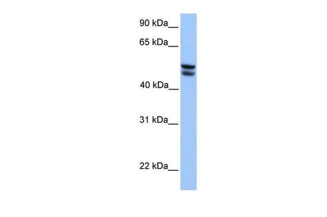 OXCT1 Antibody in Western Blot (WB)