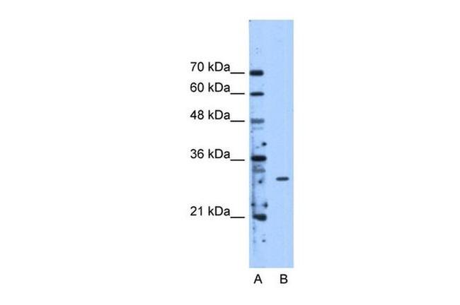 METTL1 Antibody in Western Blot (WB)