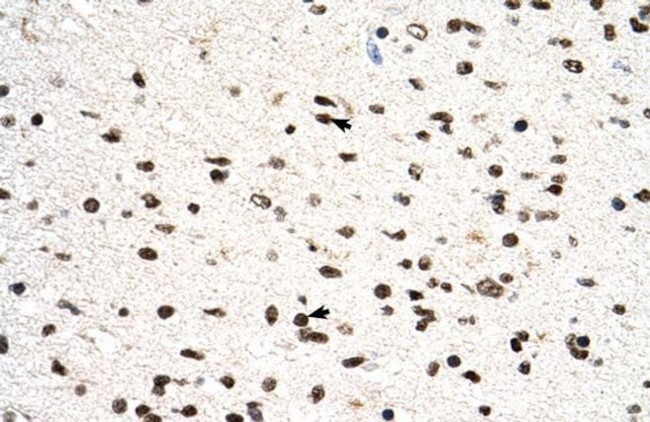 PGS1 Antibody in Immunohistochemistry (IHC)