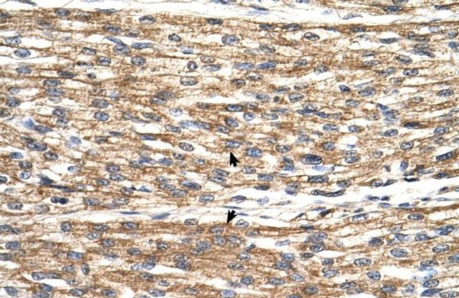 PNPLA3 Antibody in Immunohistochemistry (IHC)