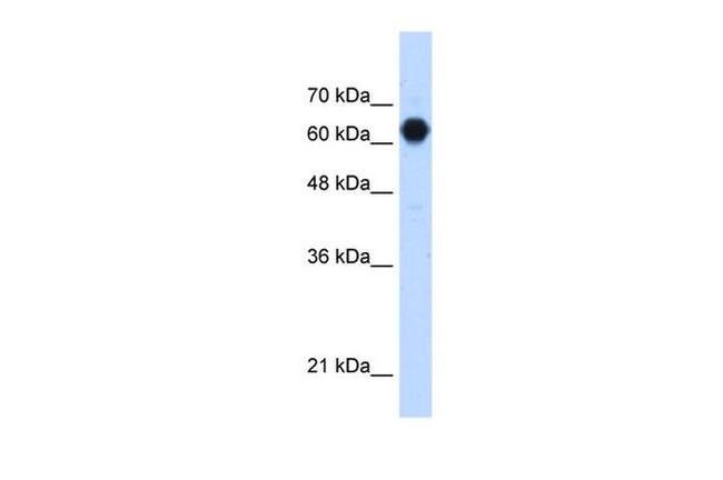 POMGNT2 Antibody in Western Blot (WB)