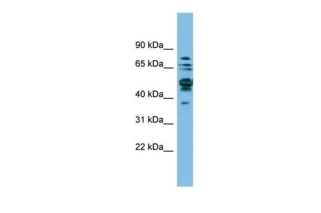 SHMT1 Antibody in Western Blot (WB)