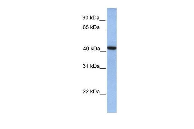 GMPPA Antibody in Western Blot (WB)