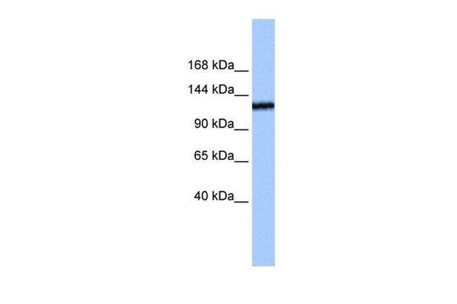 TEX2 Antibody in Western Blot (WB)
