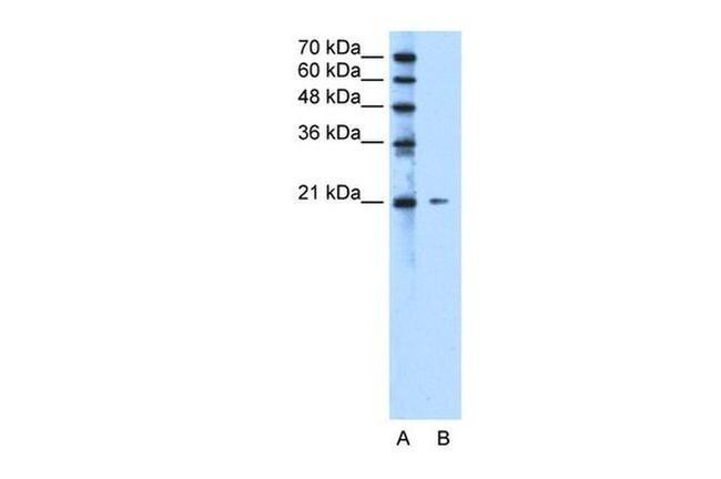 RAB5IF Antibody in Western Blot (WB)