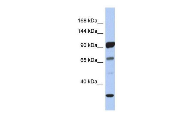 PCDHA10 Antibody in Western Blot (WB)