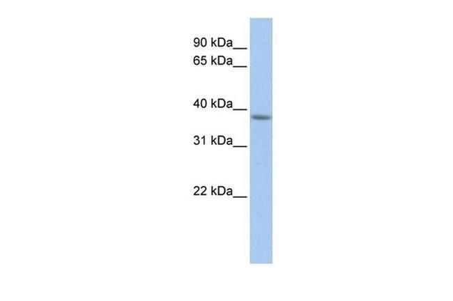 C2orf33 Antibody in Western Blot (WB)