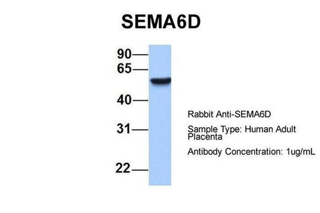 SEMA6D Antibody in Western Blot (WB)