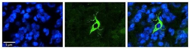 TMX4 Antibody in Immunohistochemistry (Paraffin) (IHC (P))