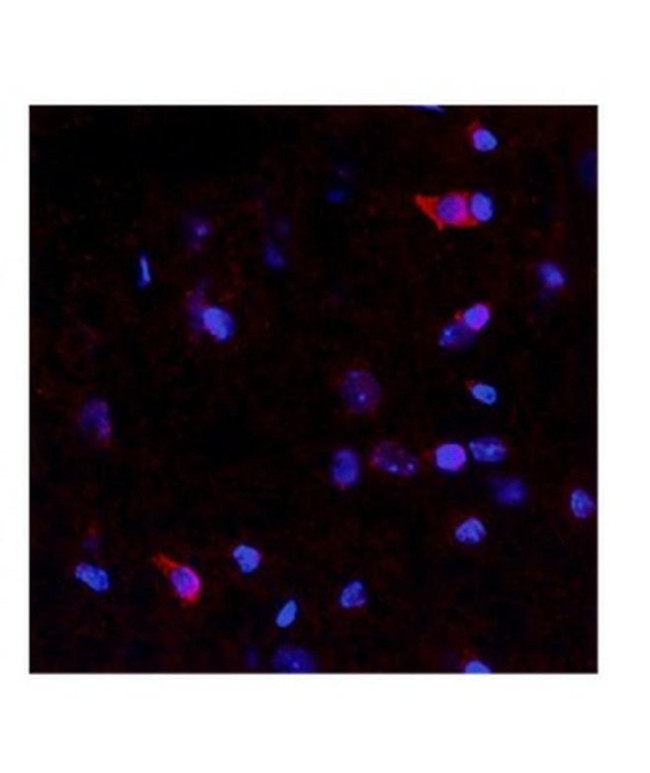 NTN4 Antibody in Immunohistochemistry (IHC)
