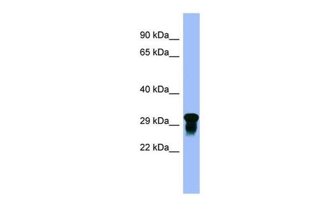 VISTA Antibody in Western Blot (WB)