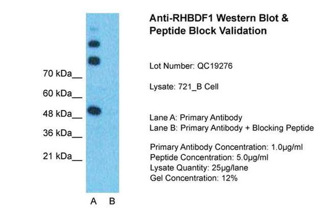 RHBDF1 Antibody in Western Blot (WB)