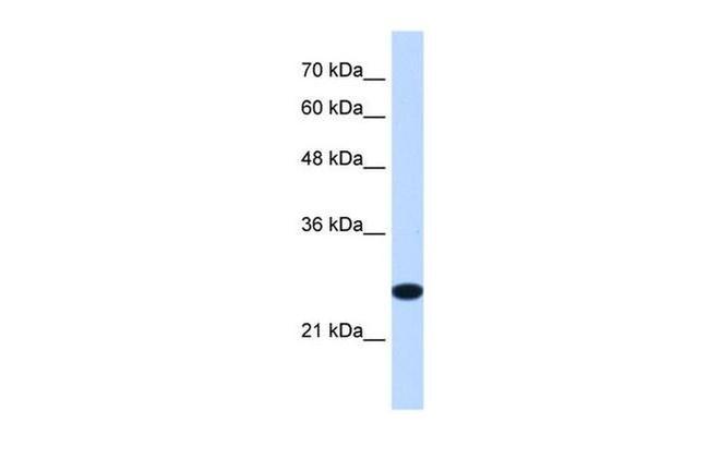 TMEM109 Antibody in Western Blot (WB)