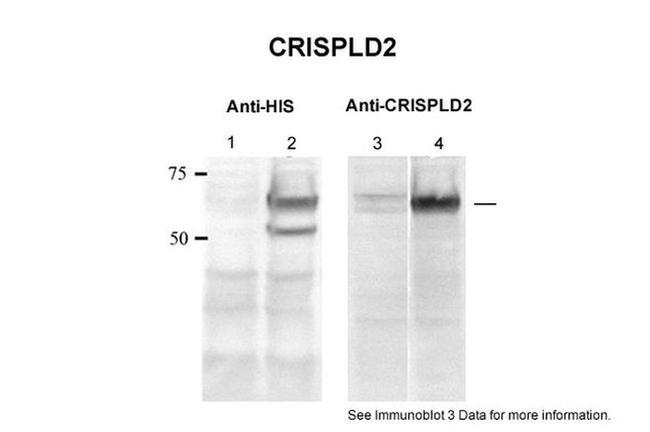 CRISPLD2 Antibody in Western Blot (WB)