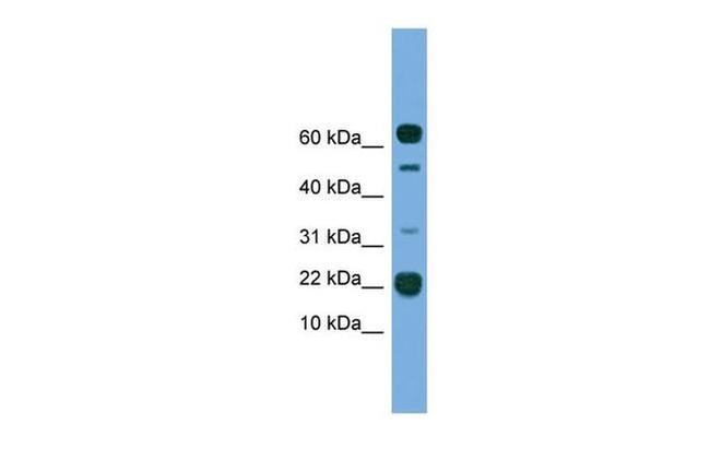 TMEM107 Antibody in Western Blot (WB)