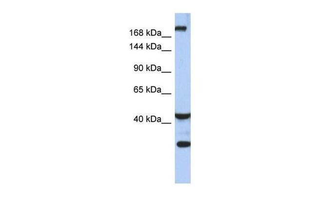 DISP1 Antibody in Western Blot (WB)