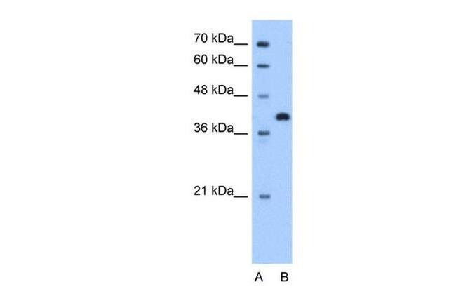 TOR2A Antibody in Western Blot (WB)