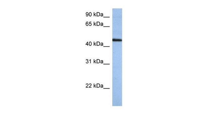 ZNF766 Antibody in Western Blot (WB)