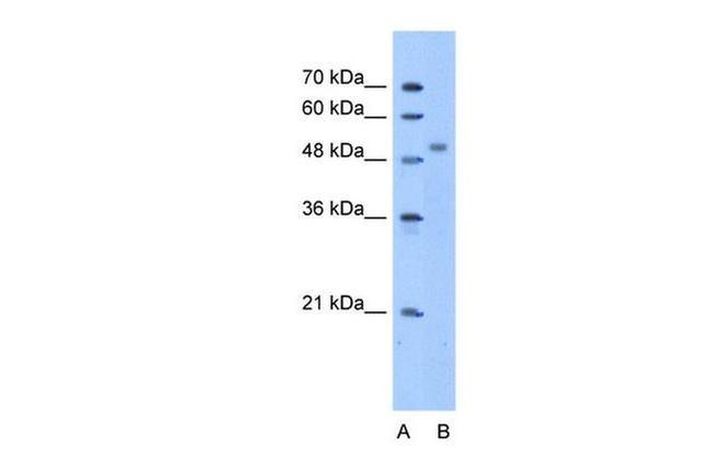 ZNF763 Antibody in Western Blot (WB)