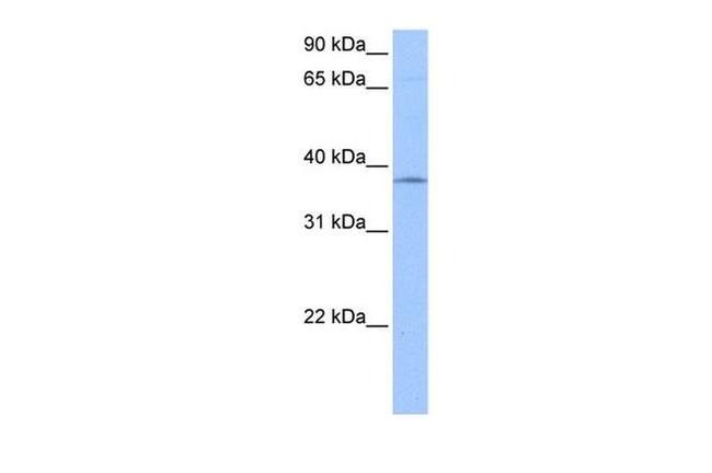 SPRY2 Antibody in Western Blot (WB)
