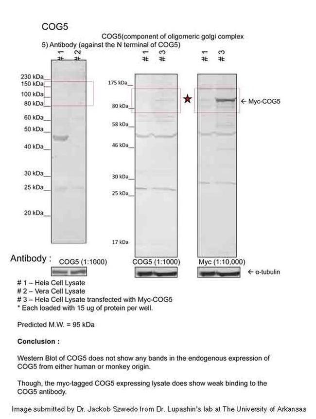 COG5 Antibody in Western Blot (WB)