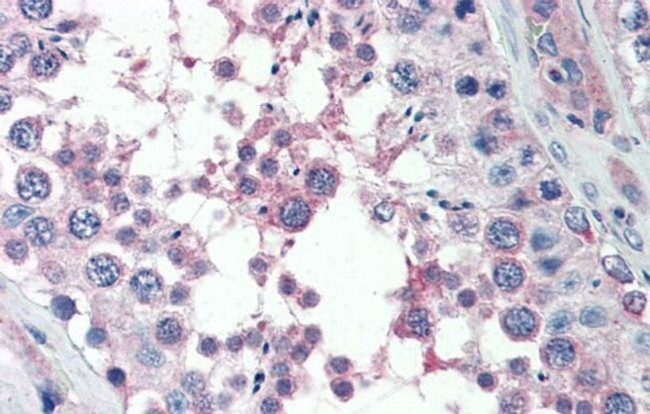 MED4 Antibody in Immunohistochemistry (IHC)