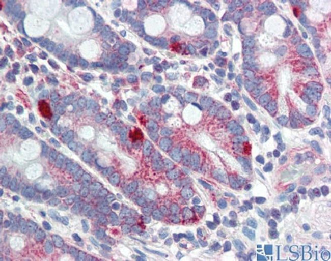 MED4 Antibody in Immunohistochemistry (IHC)