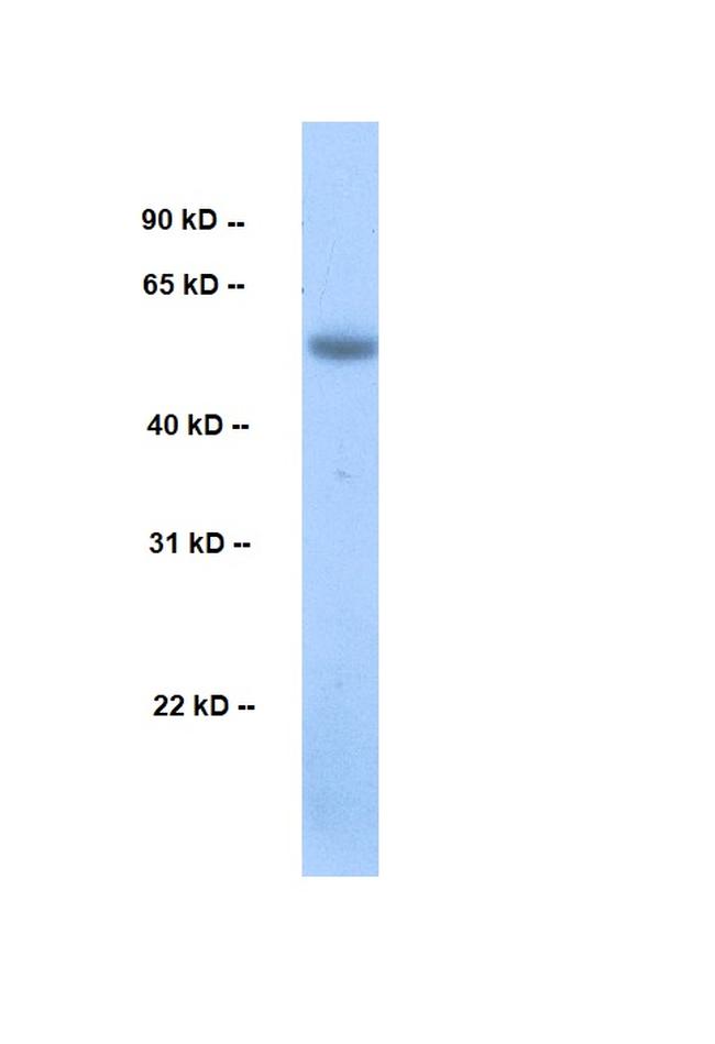 Cyclin L2 Antibody in Western Blot (WB)