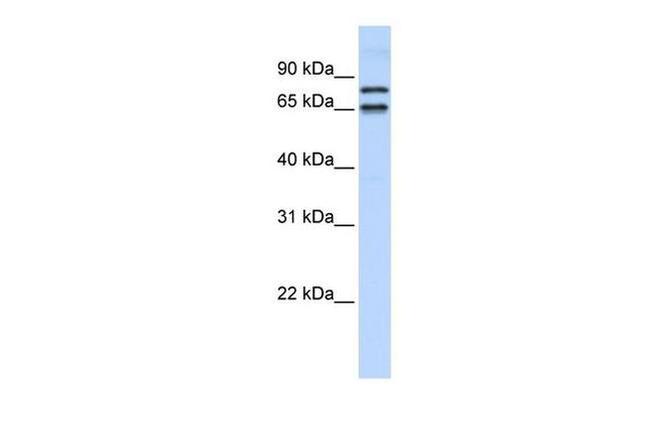 PHF20L1 Antibody in Western Blot (WB)
