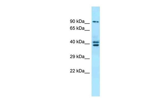 L3MBTL3 Antibody in Western Blot (WB)
