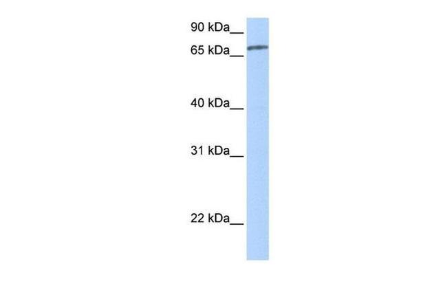 ZNF418 Antibody in Western Blot (WB)