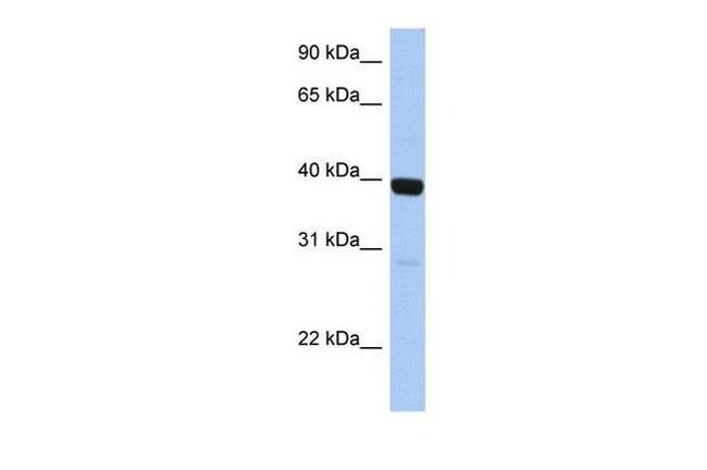 ZNF385B Antibody in Western Blot (WB)