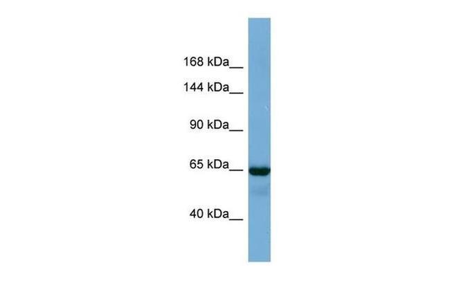 PHC1 Antibody in Western Blot (WB)