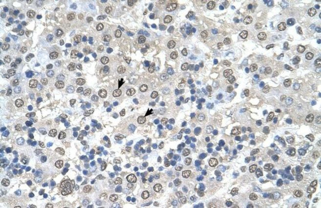 CDR2 Antibody in Immunohistochemistry (IHC)