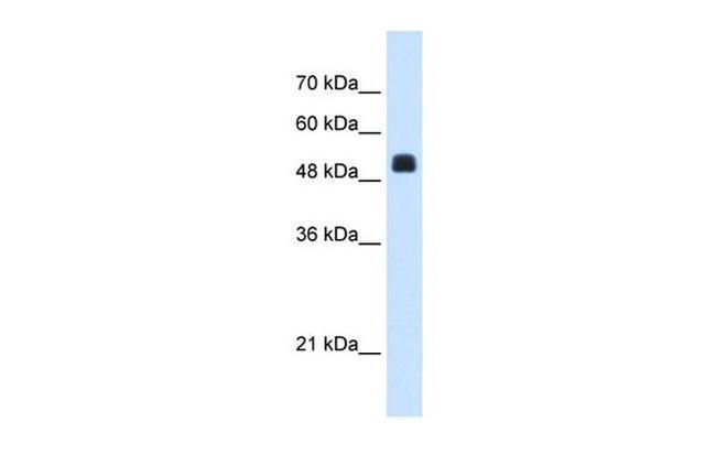 NAGS Antibody in Western Blot (WB)
