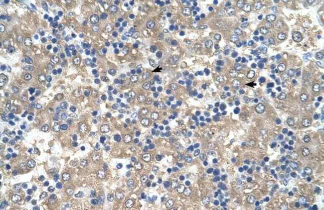 C3orf10 Antibody in Immunohistochemistry (IHC)