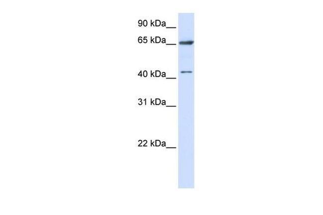 CCDC19 Antibody in Western Blot (WB)