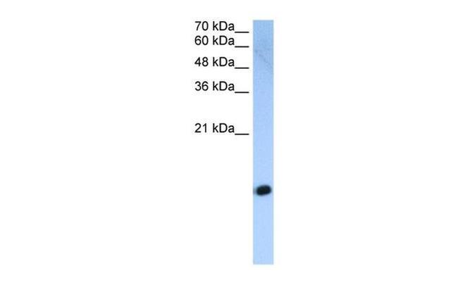 HIST2H2AC Antibody in Western Blot (WB)