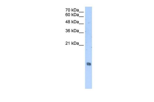 HIST2H2AA3 Antibody in Western Blot (WB)
