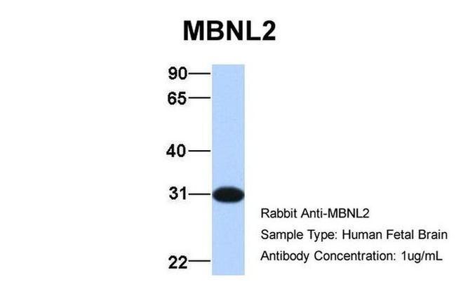 MBNL2 Antibody in Western Blot (WB)