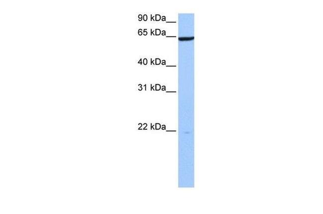 PAXIP1 Antibody in Western Blot (WB)