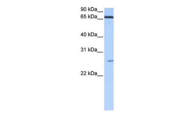 ZNF879 Antibody in Western Blot (WB)